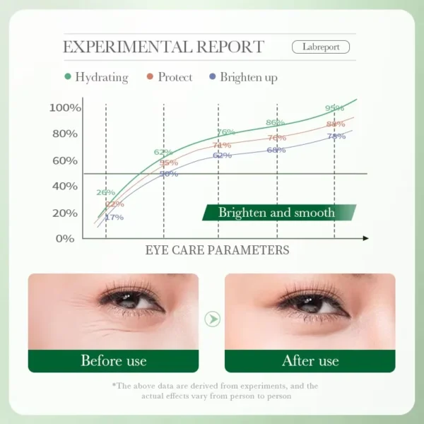 kf-S0e26c7f770ae47329db10053d096448aR SaeeNova 7 Days Tighten Under Eyes Women Skincare