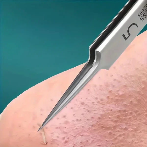 SaeeNova Tool Set For Blackhead And Pimple Household Salon Grooming