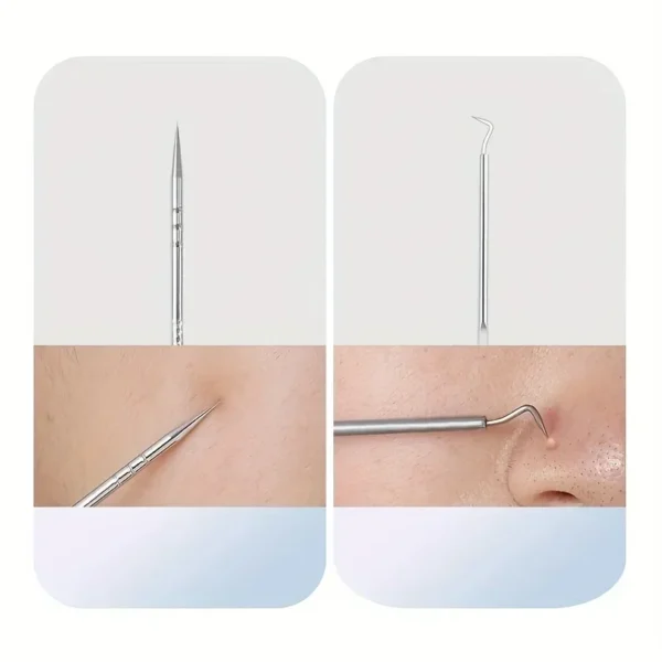 SaeeNova Tool Set For Blackhead And Pimple Household Salon Grooming